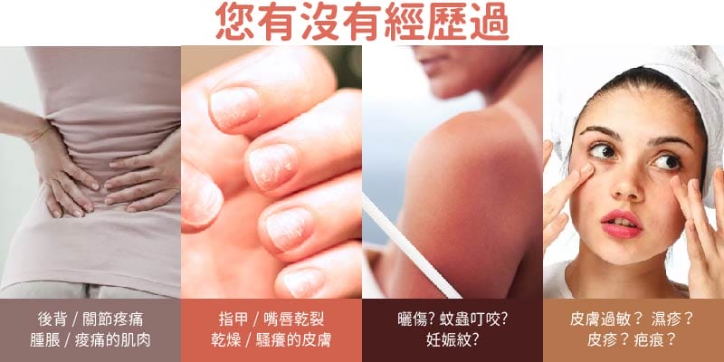 您有沒有經歷過 問題皮膚 皮膚過敏 紅腫 刺痛 曬傷 背痛 關節痛
